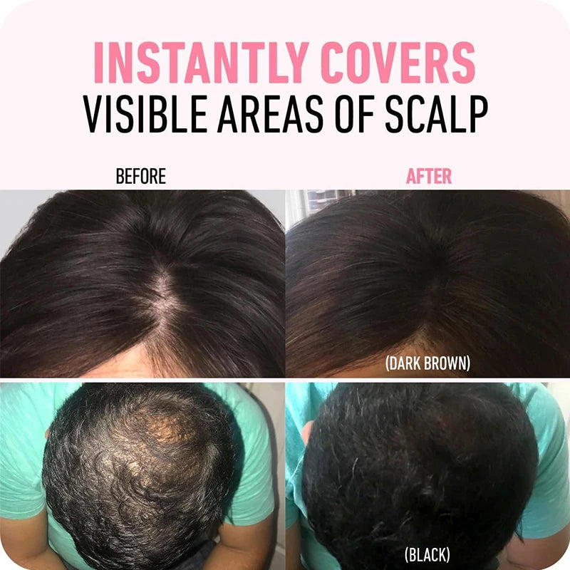 Before and after comparison showing instant coverage of visible scalp areas using waterproof hairline shadow powder for root 