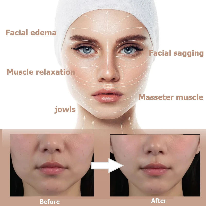 Before and after comparison showing the effect of Invisible V-Lift Face Stickers on facial features.