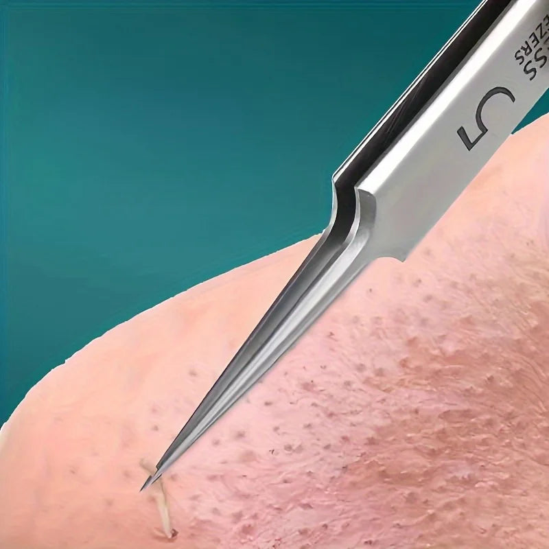A stainless steel blackhead remover tool with a pointed tip is shown against light skin.