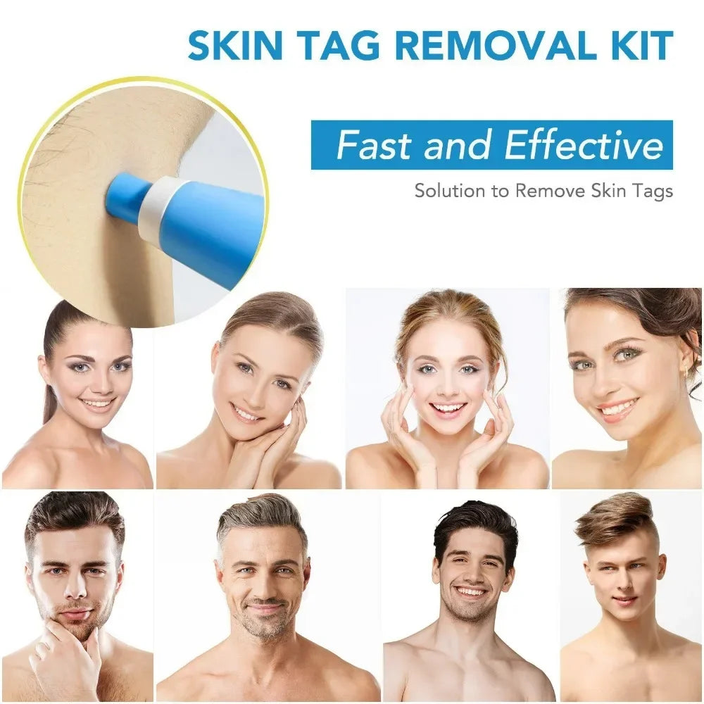 A set of skin tag removal tools and a kit for painless skin tag removal shown on various skin tones.