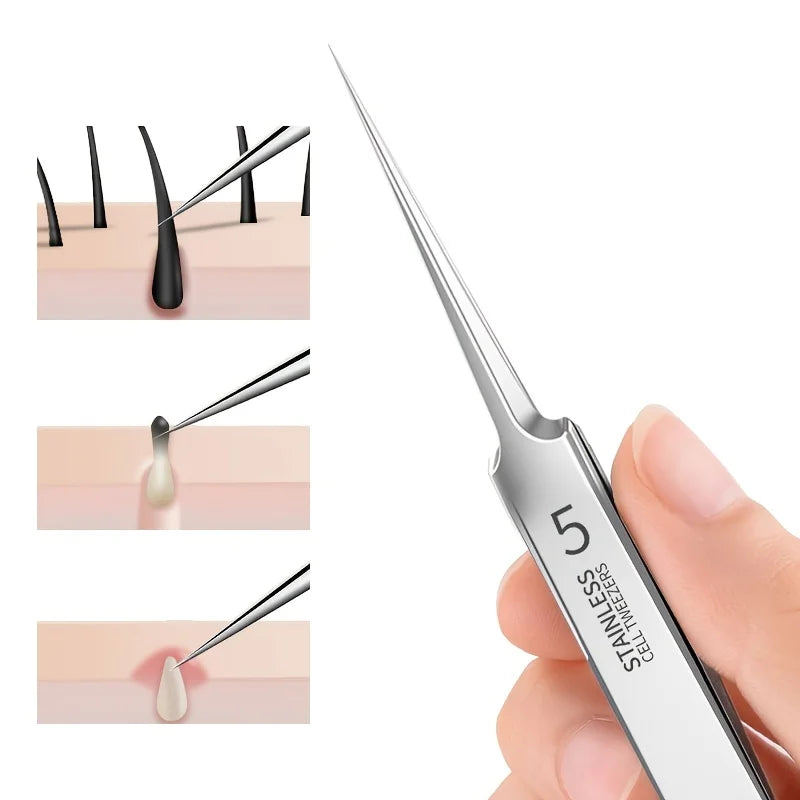 Stainless steel tweezers used to remove blackheads, shown in various applications.