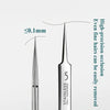 A close-up view of stainless steel tweezers used for fine-precision occlusion and cell removal.